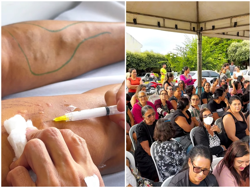 MAIS DE 200 PESSOAS SÃO ATENDIDAS EM MUTIRÃO DE TRATAMENTO VASCULAR EM COCOS